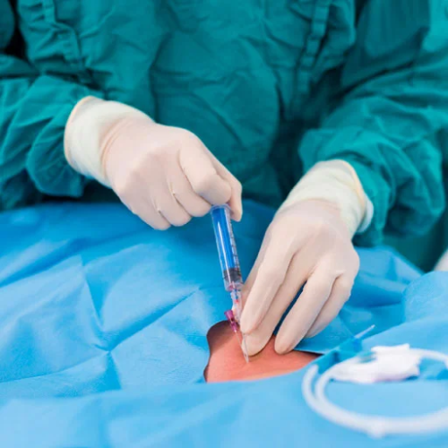 Angioplastias Periféricas